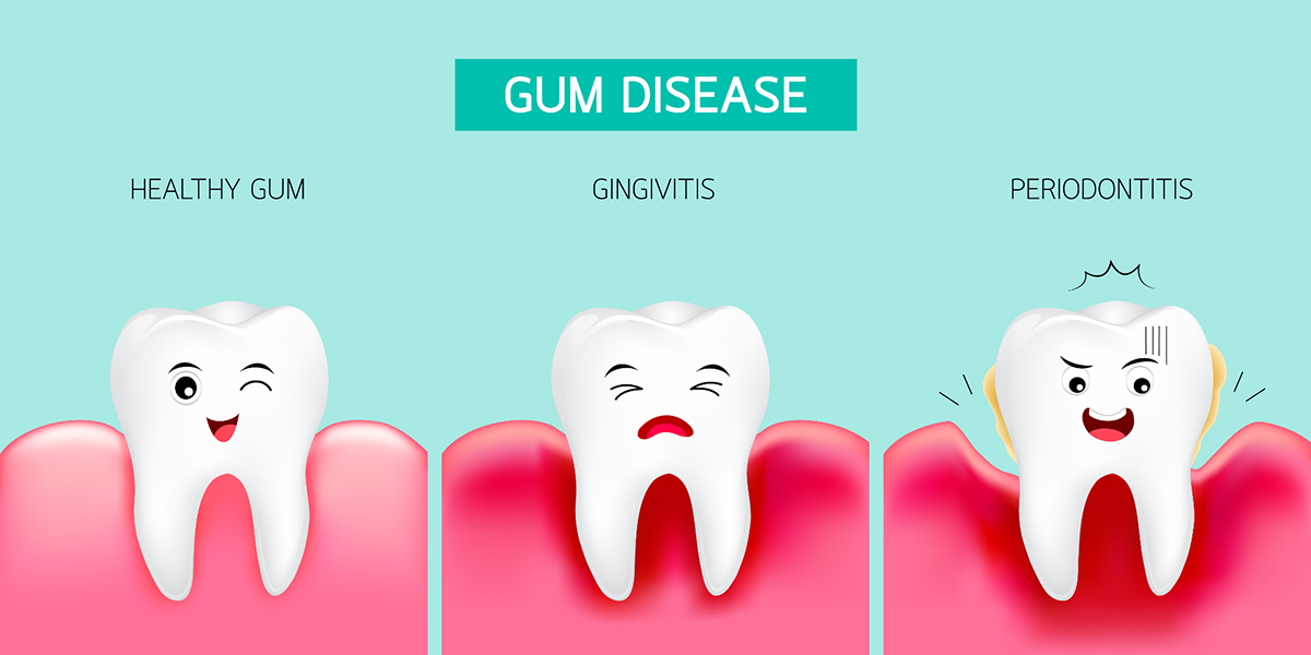 Gum Disease | St. Lawrence Dentistry
