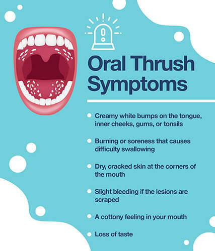 otc oral thrush medication